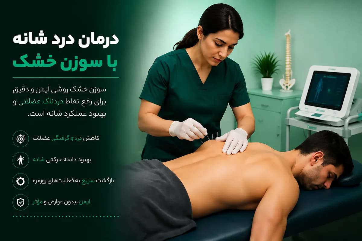 Shoulder Pain Treatment with Dry Needling