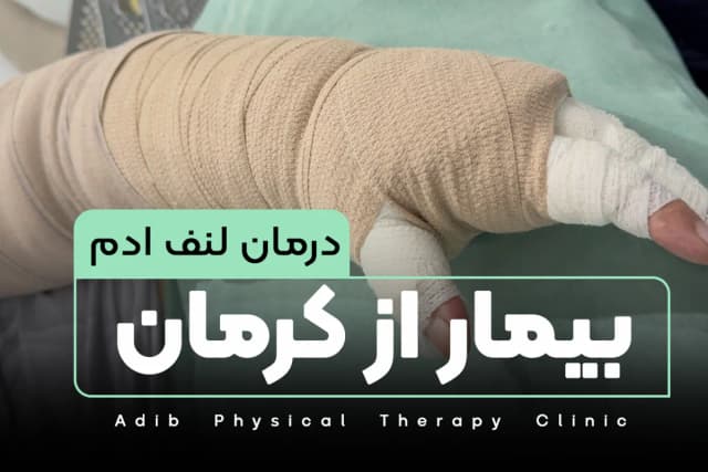 درمان لنف ادم بیمار از کرمان