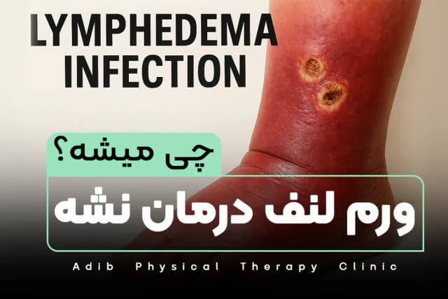 ورم لنف درمان نشه چی میشه؟